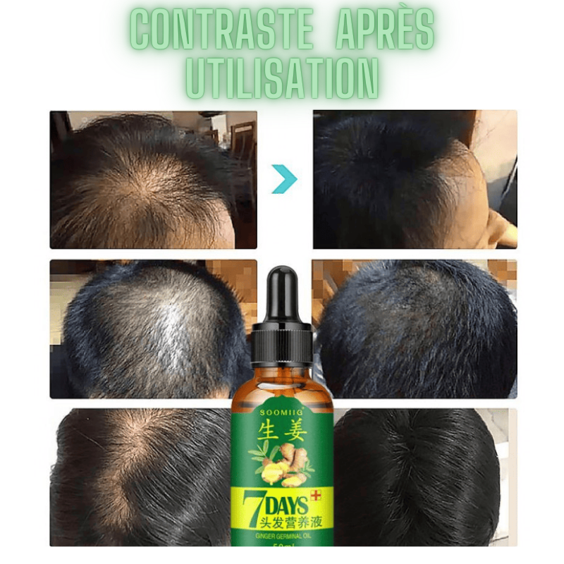 DayHair™ Spray croissance cheveux pour hommes et femmes