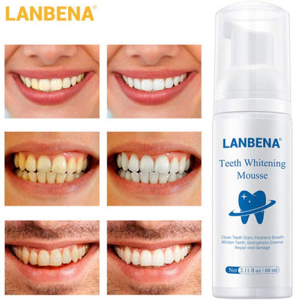 Mousse de blanchiment des dents ( 01 Stylo Blancheur offert)