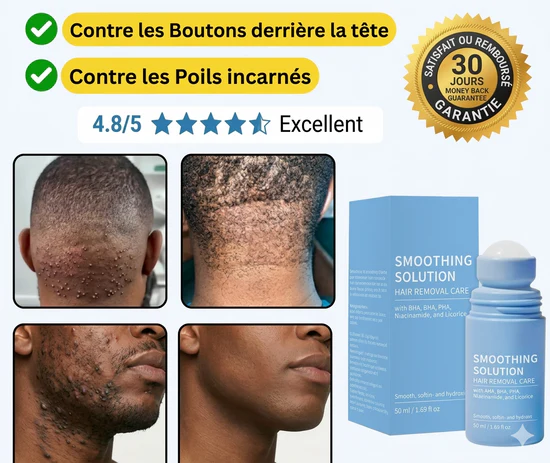Fini les boutons derrière la tête & sous barbe après rasage