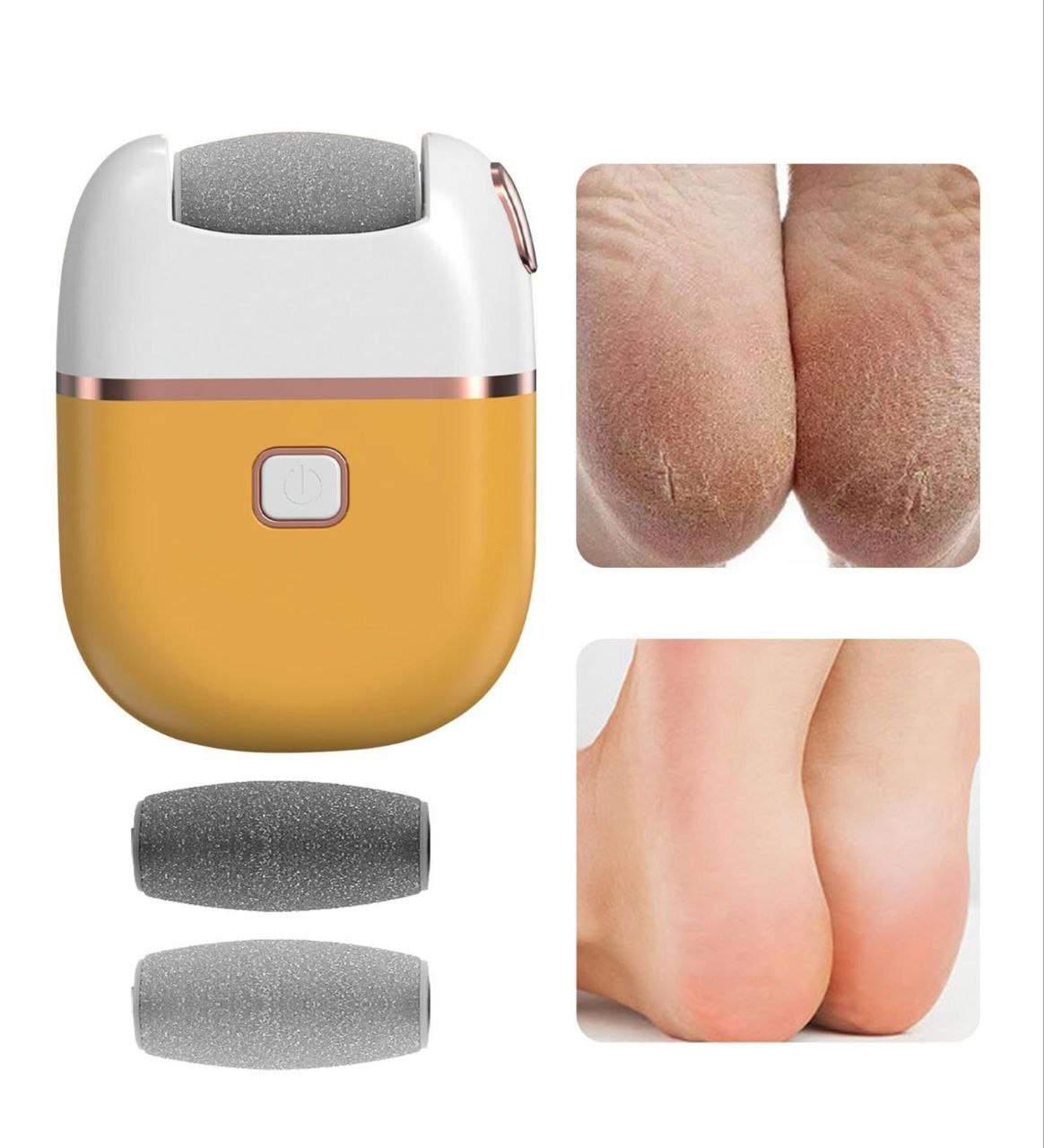 Appareil™ de Pédicure -Votre alliée beauté pour des pieds doux et impeccables à la maison !
